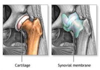 Joints pain relief